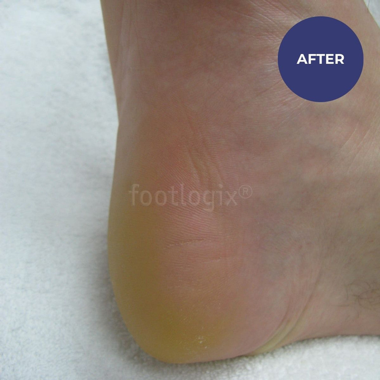 Footlogix Daily Maintenance Formula (125ml)